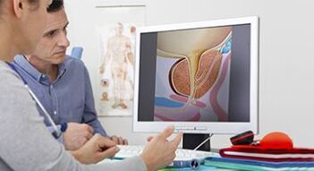 diagnostika prostatitídy u mužov