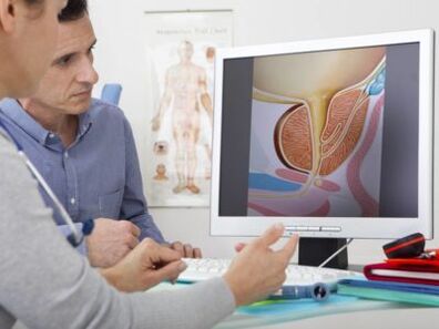 Urológ konzultuje pacienta o prostatitíde a metódach jej liečby.